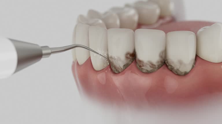 Trusted Dental Crowns And Bridges service in Chester Gap, VA - Dentist Open Now
